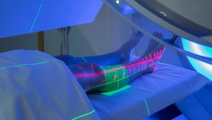 Strahlentherapie 