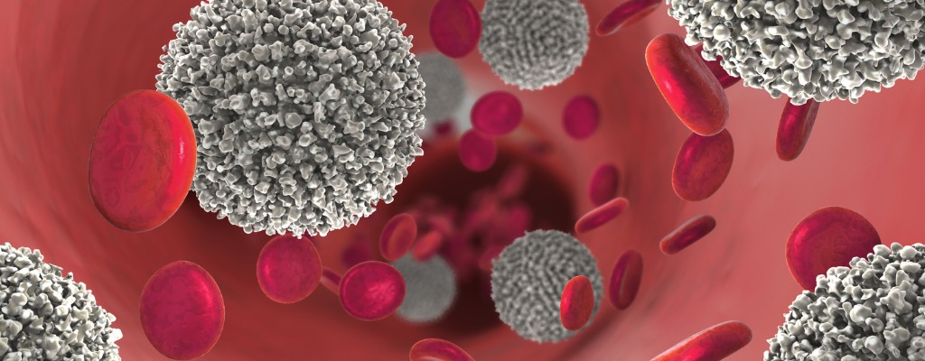 Was ist eine Leukämie?