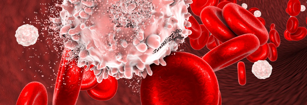 Leukämie (Blutkrebs)