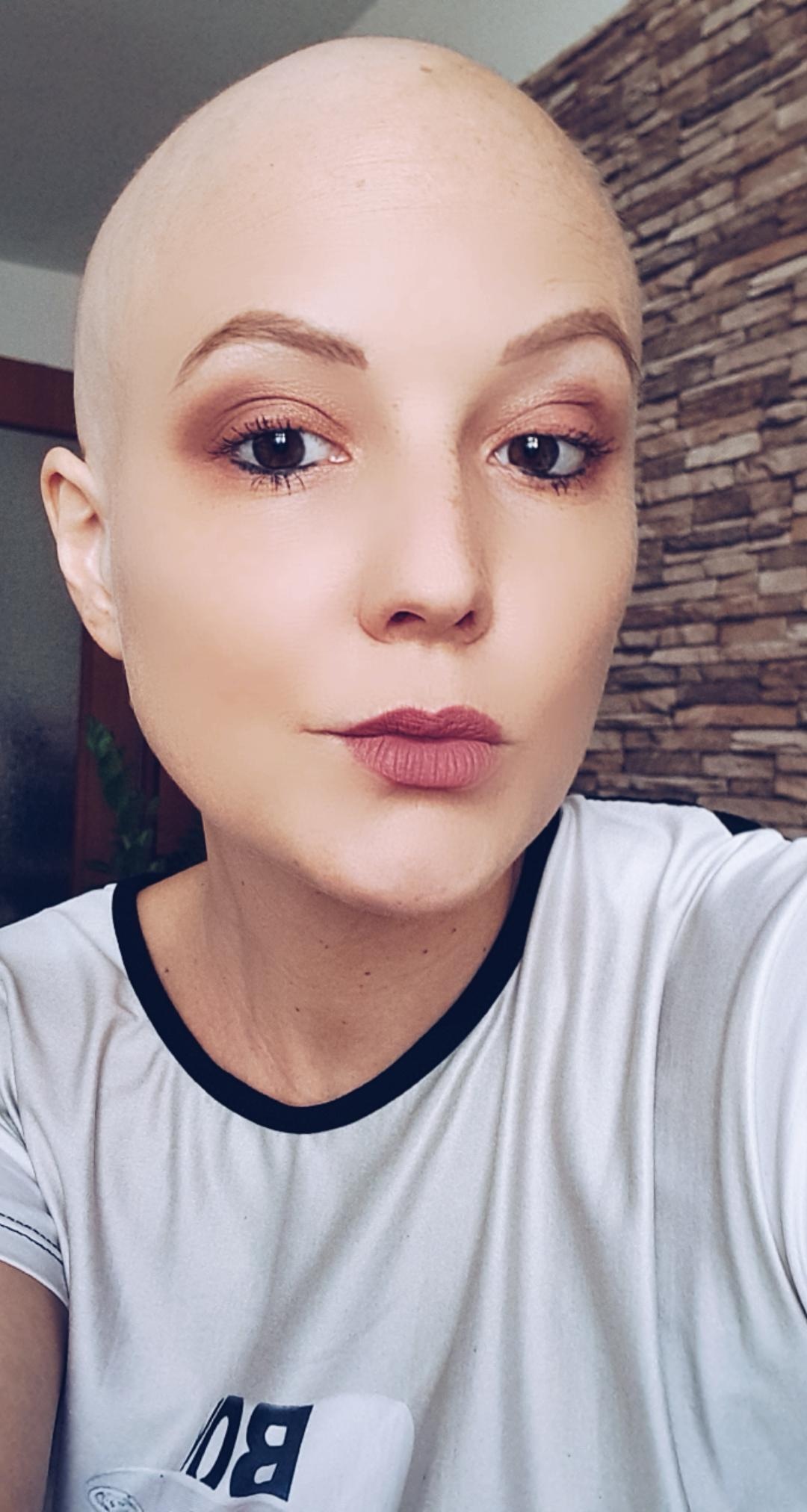 Jenni - Hodgkin Lymphom