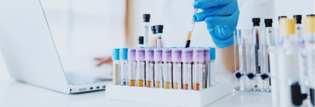 Welche Krebsarten gibt es?