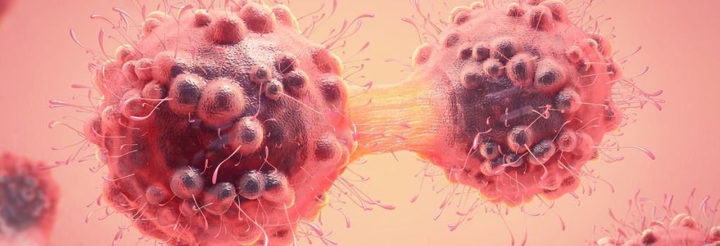 Metastasen bei Krebs