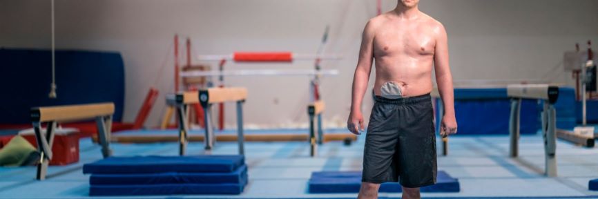 Stoma nach der Krebsoperation