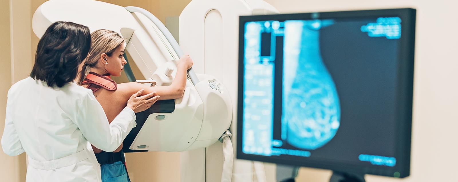 Was ist eine Mammographie? Wie läuft die Untersuchung ab und was muss man beachten?