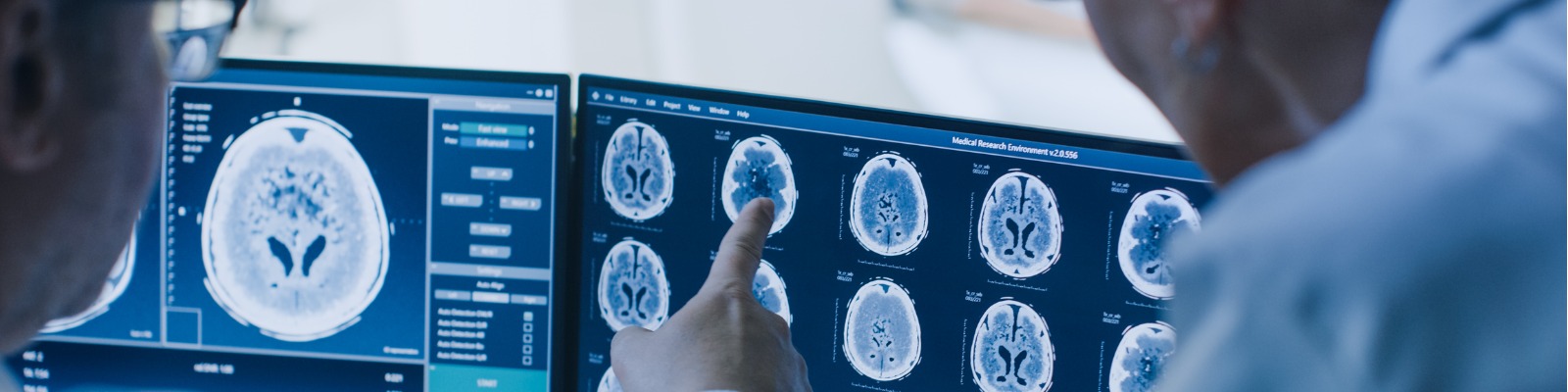 Kontrastmittel in der CT