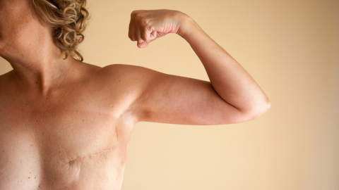 Hautpflege bei Narben und Pigmentflecken