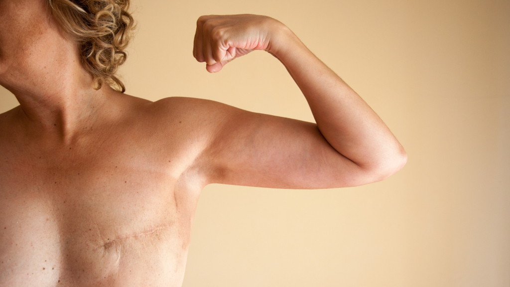 Hautpflege bei Narben und Pigmentflecken