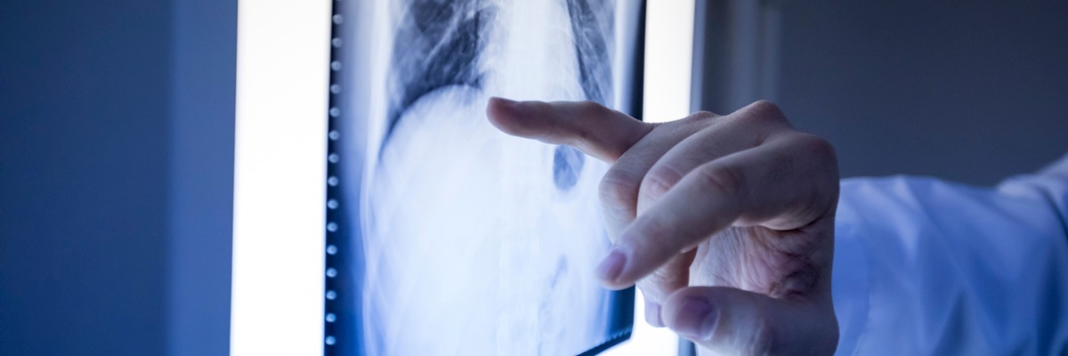 Beschwerden bei Knochenmetastasen