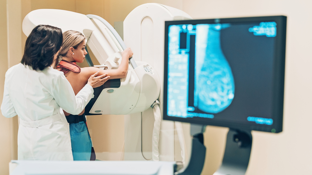 Mammographie