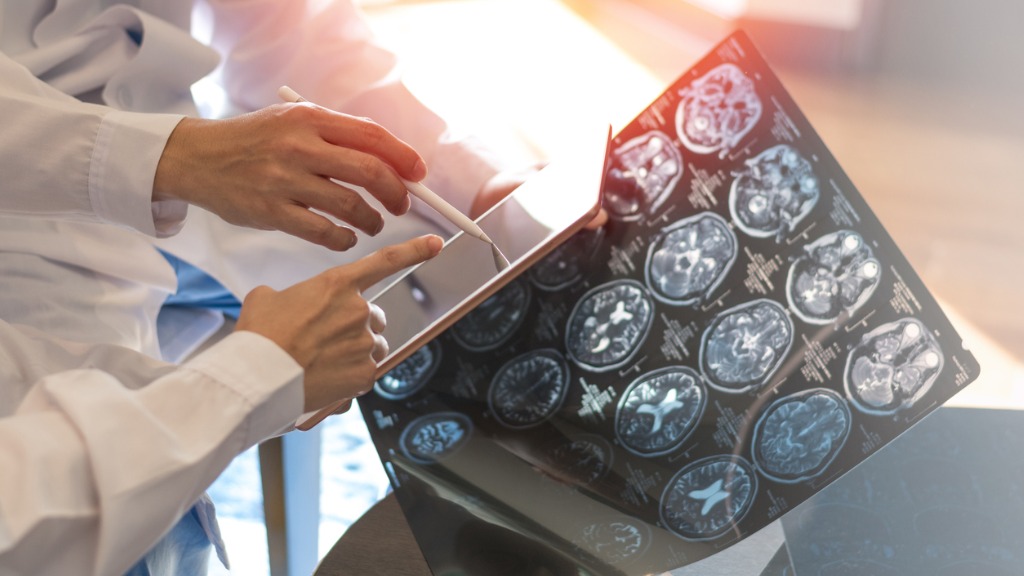 Strahlentherapie bei Krebs Was Patienten wissen sollten