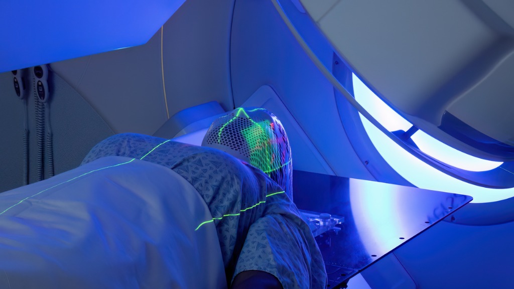 Frau mit Immobilisierungsmaske in ZAP-X Gerät 