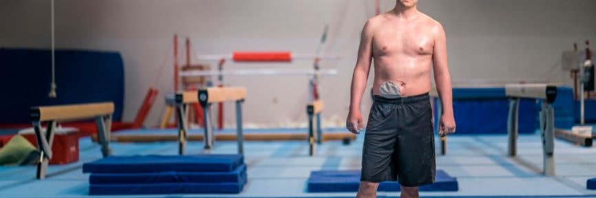 Stoma nach der Krebsoperation. Bleiben Sie aktiv. Sport trotz Stoma.