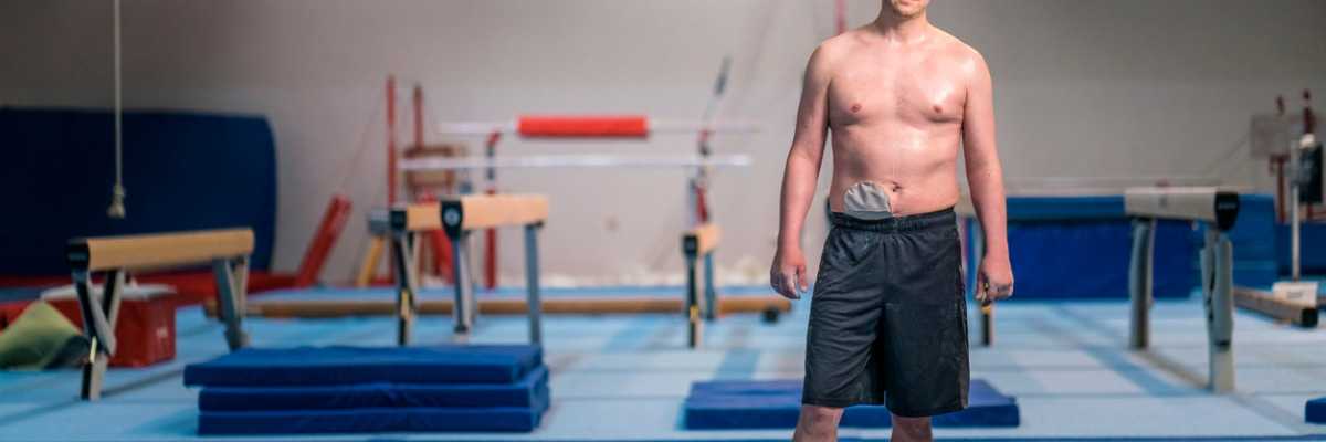 Sport trotz Stoma. Verringern Sie selbst durch körperliche Aktivität Ihre Nebenwirkungen der Krebstherapie. Tipps und Hilfestellungen