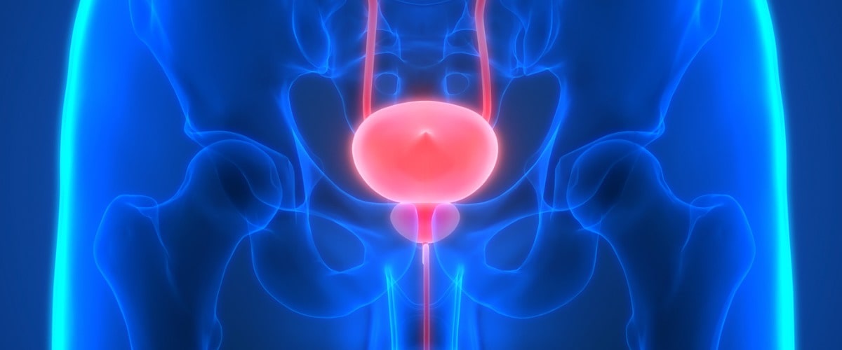 Prostatakrebs: bösartigen Tumor der Vorstehdrüse.