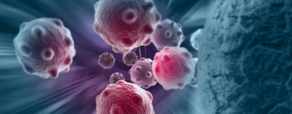 Krebs - Was macht Krebs im Körper? Krebsrisiko, Ursachen, Arten, Häufigkeit