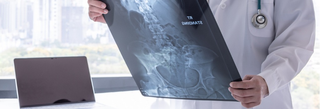 Therapiemöglichkeiten Darmkrebs