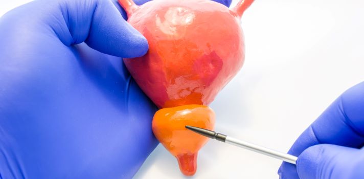 Therapiemöglichkeiten bei Prostatakrebs (Prostatakarzinom)